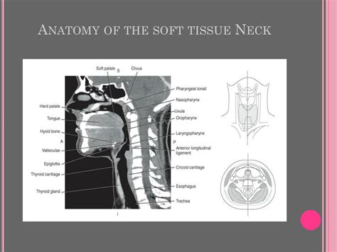 soft tissue neck anatomy.